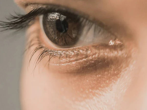 Under-Eye