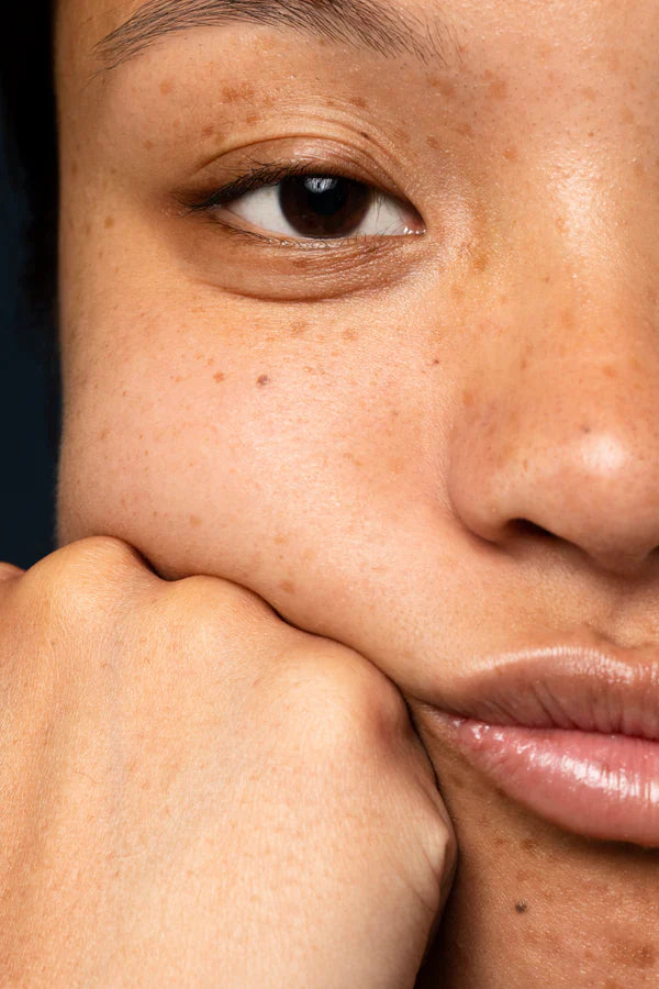 Anti-Pigmentation