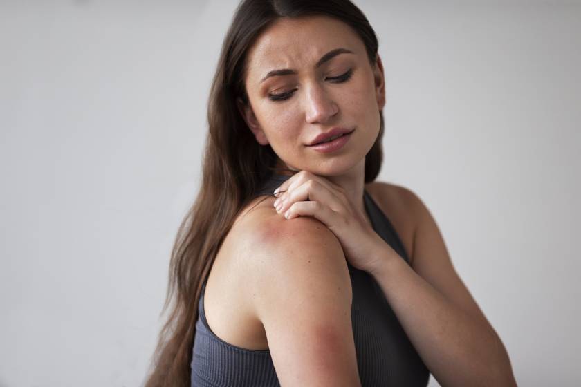 Atopic Dermatitis