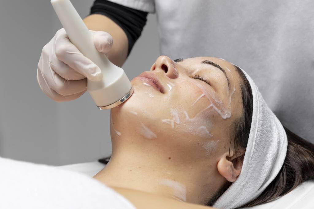 Chemical Peels