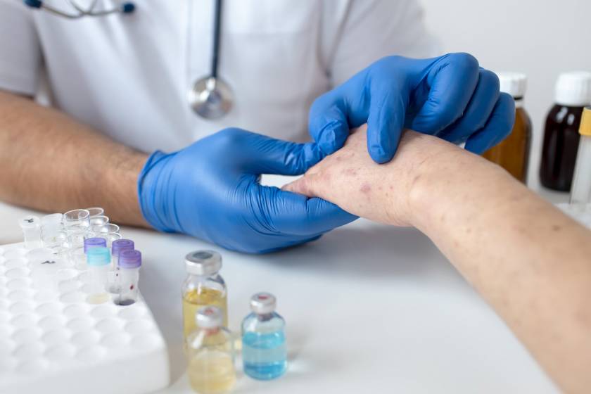 Fungal Infections