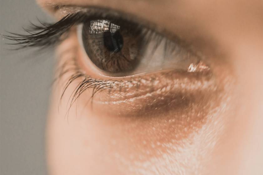 Dark Circles